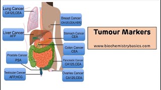 Tumour Markers  Tumour Markers Biochemistry [upl. by Oiredised416]