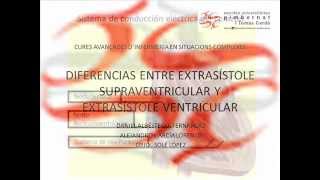 Extrasístole diferencias entre supraventricular y ventricular [upl. by Elatsyrc]