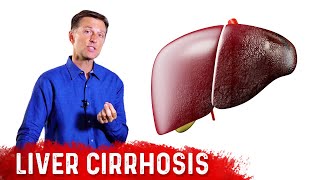 What Causes Itching in Liver Disease and How to Treat It  Tita TV [upl. by Esiralc]