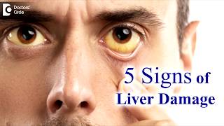 9 Signs of Toxin Buildup in the Liver [upl. by Anatnahs406]