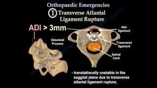 Orthopaedic Emergencies Part 4  Everything You Need To Know  Dr Nabil Ebraheim [upl. by Katti]