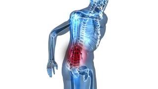 Back Pain Linked to Knee Pain [upl. by Greenburg]