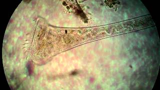 Protist under the microscope [upl. by Eceinehs]