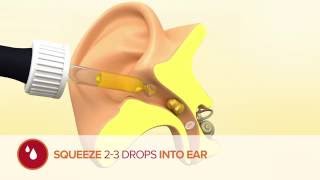 How to use Otex Olive Oil Ear Drops [upl. by Vernon759]