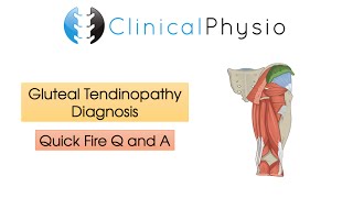 Classic Gluteal Tendinopathy Diagnosis  Clinical Physio [upl. by Ramo565]