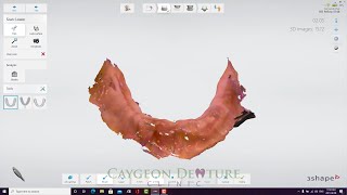 Scanning Workflow to Fabricate a Complete Lower Denture [upl. by Anaeed584]