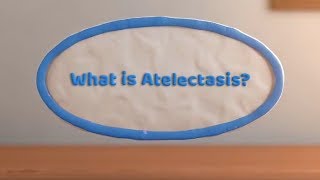 What is Atelectasis Complete or Partial Lung Collapse [upl. by Maible742]