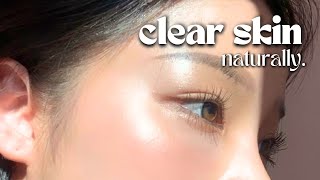 How I Cleared My Skin In 8 Weeks naturally [upl. by Alvera845]