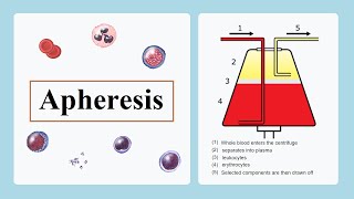 apheresis [upl. by Utimer]