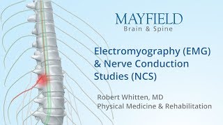 Electromyography EMG amp Nerve conduction studies NCS [upl. by Etnasa]