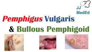 Vesiculobullous Skin Diseases  Pemphigus Vulgaris vs Bullous Pemphigoid [upl. by Nonnerb]