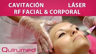 Cavitación  Radiofrecuencia Facial y Corporal  Láser [upl. by Seadon]