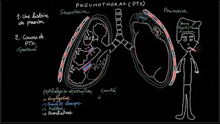 Pneumothorax  Docteur Synapse [upl. by Ahsitam920]