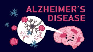 Experience 12 Minutes In Alzheimers Dementia [upl. by Alag]