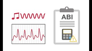 Interpreting ankle brachial index ABI waveforms [upl. by Singh]