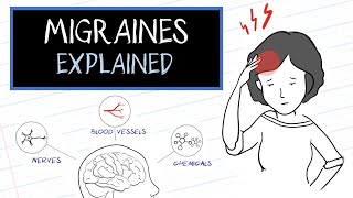 Migraines 101 Symptoms [upl. by Suoiluj]