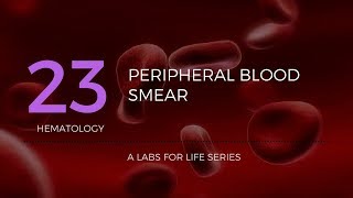 Part 1  Preparation of Peripheral Blood Smear PBS [upl. by Enenaj736]