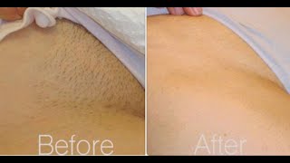 Brazilian Waxing 101 All You Need To knowTips [upl. by Aierbma]