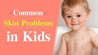 6 Common Skin Problems in Children [upl. by Eneri]