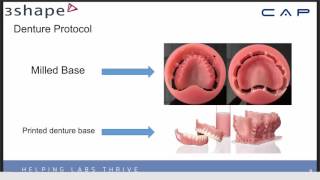 Digital Dentures What You Need to Know [upl. by Erastatus]