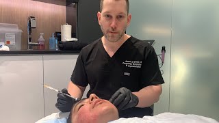 How to Get Rid of Acne Scars  Dermal FillerSubcision  Acne Scar Combination Tx  Part 1  Dr Emer [upl. by Charbonneau401]