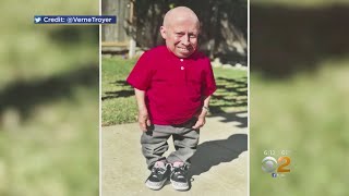 Actor Verne Troyer Dead At 49 [upl. by Dercy916]