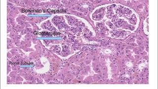 Kidney Cancer Surgeries amp Procedures  National Kidney Foundation [upl. by Nichole]