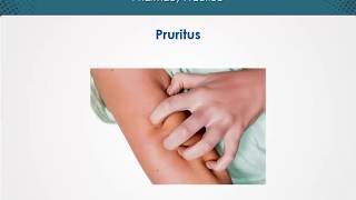 Pruritus  Dermatology  EduRx [upl. by Sudderth]