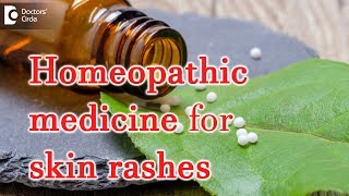 Homeopathic medicine for skin rashes  Dr Surekha Tiwari [upl. by Ahsinrat]