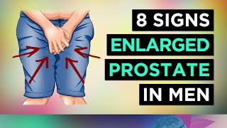 8 Signs You Have ENLARGED Prostate BPH  Men [upl. by Odlavso]