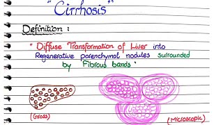 Cirrhosis of Liver  Pathology [upl. by Taddeusz]