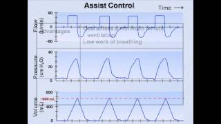 Ventilator Modes Mechanical Ventilation  Lecture 7 [upl. by Sseb572]