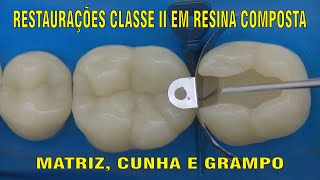 Restauração Classe II em Resina Composta  PARTE 1 [upl. by Arch]