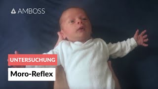 MoroReflex  Frühkindliche Reflexe  AMBOSS Video [upl. by Moffit]