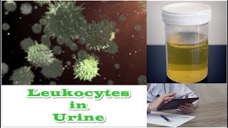 Leukocytes in Urine  No Nitrates [upl. by Xet827]