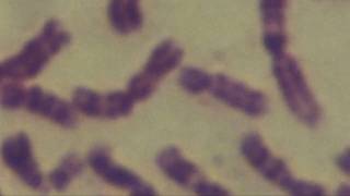 Cytogenetics Human chromosomes Karyotype [upl. by Annaihr]