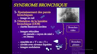 syndrome bronchique partie 03 DDB [upl. by Dowell136]