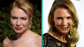 What Did Renee Zellweger Do to Her Face Plastic Surgeon Weighs In [upl. by Winfred]