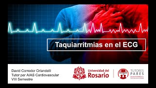 Lectura de Electrocardiograma 4 Taquiarritmias supraventriculares [upl. by Elyc]