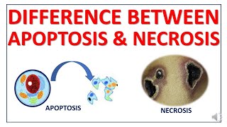 Difference between Apoptosis and Necrosis [upl. by Uranie]