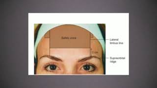 Filler for Forehead Wrinkles procedure [upl. by Atirrehs539]