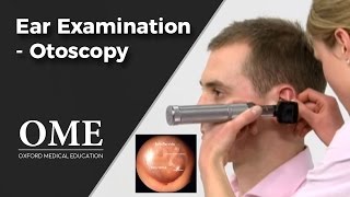 Otoscopy Ear Examination  ENT [upl. by Orgell435]