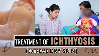 What is ichthyosis  Ichthyosis Causes Symptoms amp Treatment  Dr Priyanka Reddy [upl. by Oj]