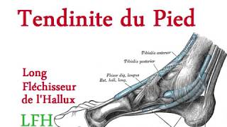 Tendinites du pied [upl. by Htes]