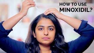 How To Use Minoxidil  Hair Regrowth  Skin Diaries [upl. by Ahsekin121]