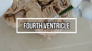 Fourth ventricle  neuroanatomy  floor  opening [upl. by Fausta]