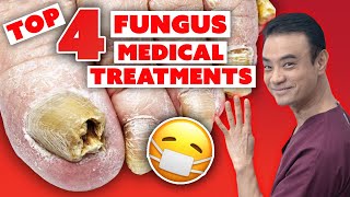 4 MEDICAL treatments to get rid of toenail fungus  Holistic Toenail Fungus Cures Part 3  Dr Kim [upl. by Maddie]