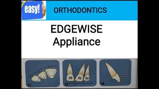 edgewise appliance [upl. by Remled]