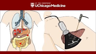 Introduction to Biliary Ultrasound [upl. by Hilaire993]