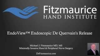 EndoTech® Endoscopic De Quervains Surgery  Fitzmaurice Hand Institute  Phoenix Arizona [upl. by Navek]